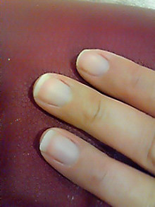 爪の悩みを解消!ネイルサロンオーナーのブログ-201107171209000.jpg